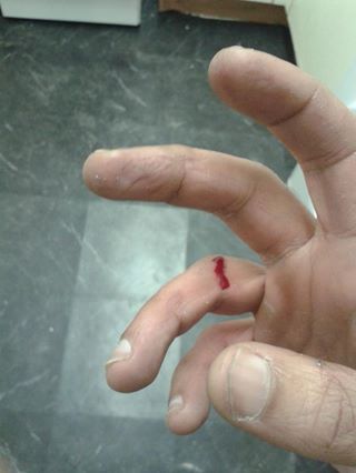 Hand cuts